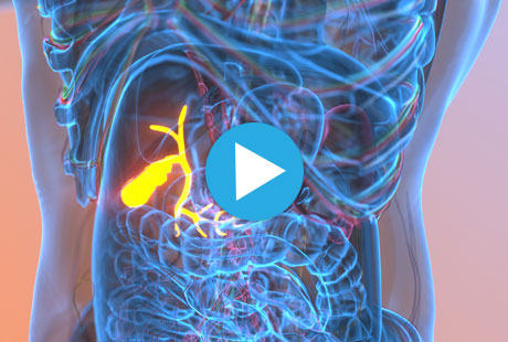 Gallbladder x-ray